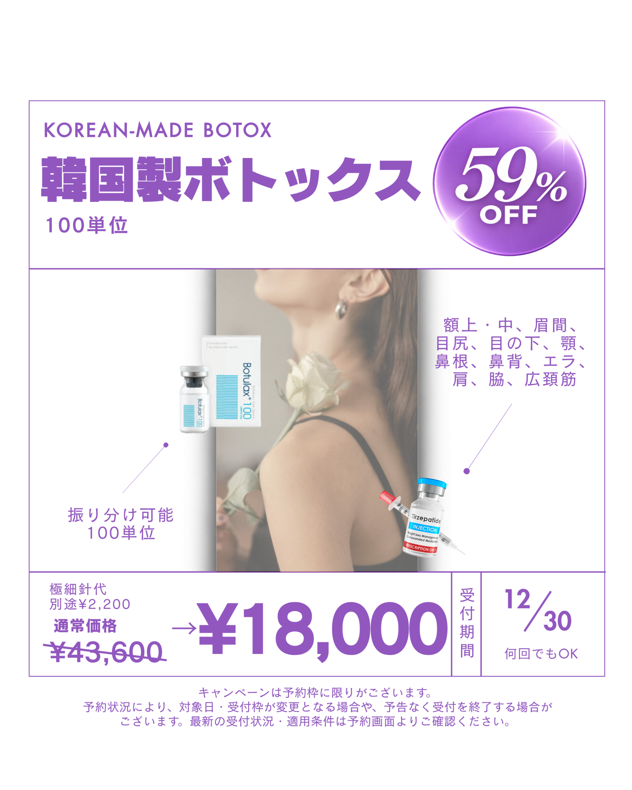 キャンペーン